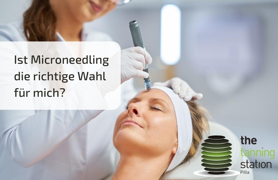 Read more about the article Ist Microneedling die richtige Wahl für mich?