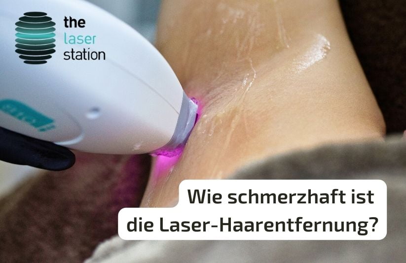 Wie schmerzhaft ist die Laser-Haarentfernung? Laserhaarentfernung Schmerzen