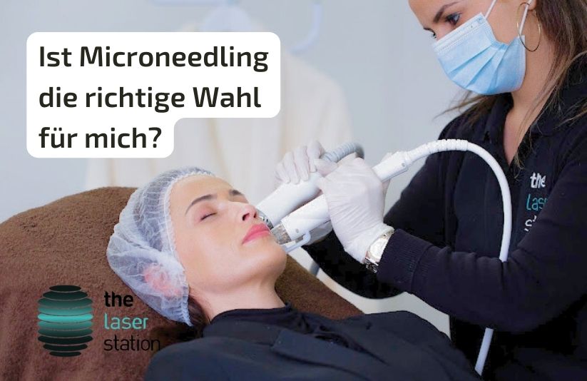Read more about the article Ist Microneedling die richtige Wahl für mich?