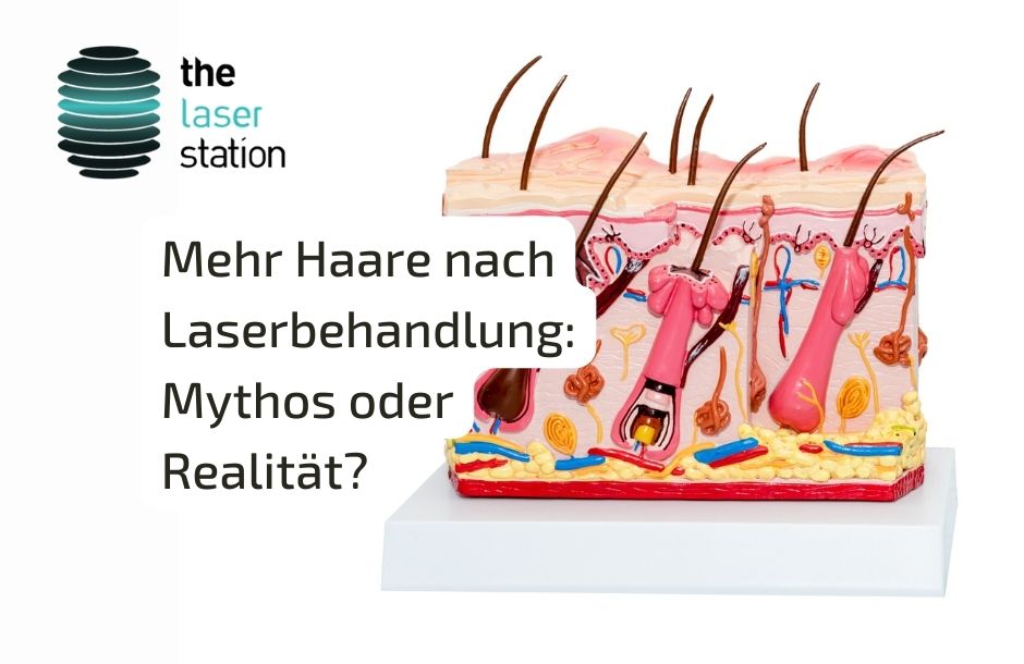 Read more about the article Mehr Haare nach Laserbehandlung: Mythos oder Realität?