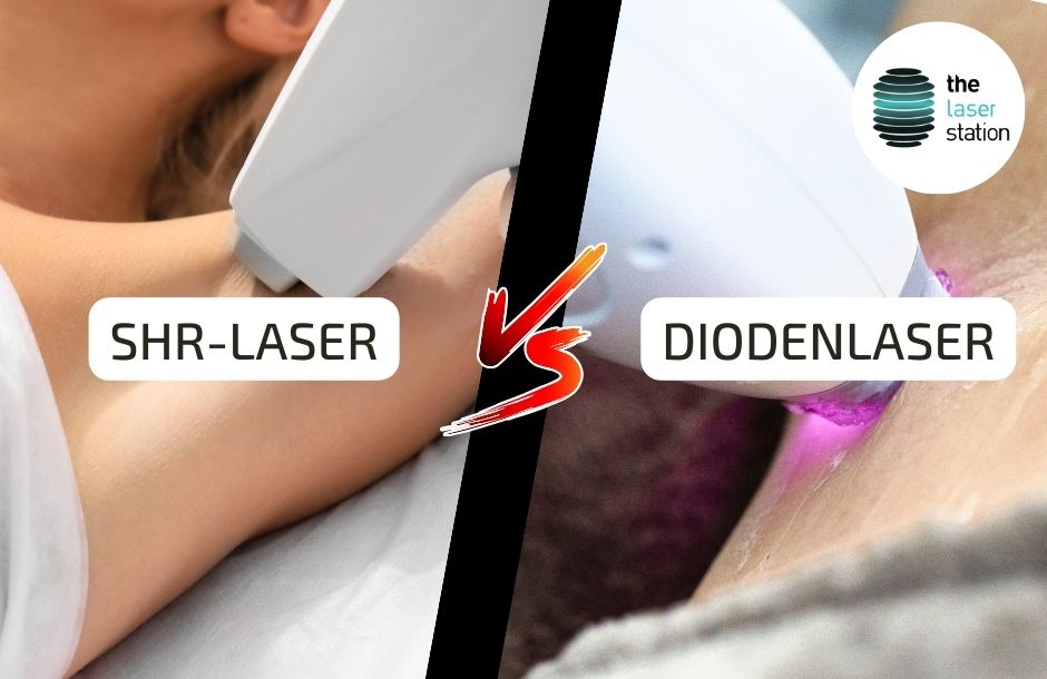 Read more about the article SHR vs. Diodenlaser Haarentfernung – Was passt zu Ihnen?