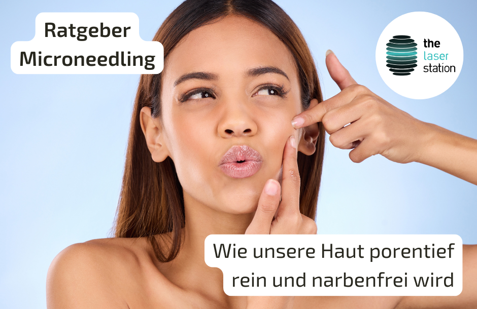 Mehr über den Artikel erfahren Microneedling & Narben: Was hilft wirklich gegen Narbengewebe?